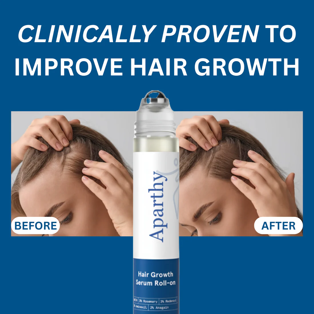 Advanced Hair Growth Roll-On Serum.