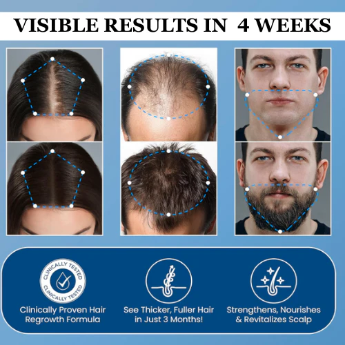 Advanced Hair Growth Roll-On Serum.
